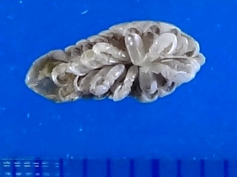 サヨリヤドリムシ？（腹面）